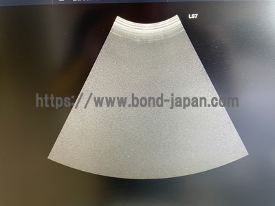 Color Doppler | GE | Logiq S7 Expert