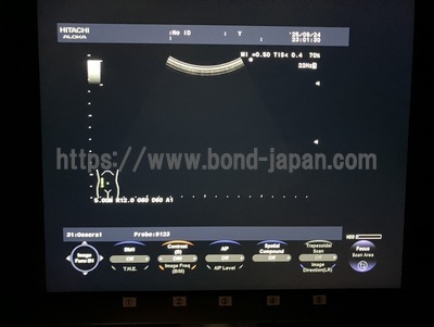 Color Doppler | HITACHI | F37