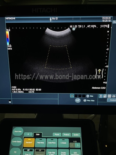 Ultrasound System | FUJIFILM | ARIETTA 850