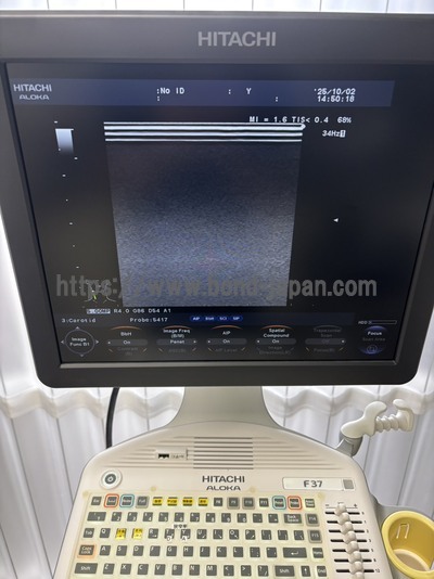 Color Doppler | HITACHI | F37