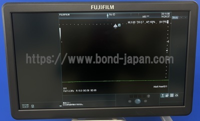 超音波診断装置/カラードプラ&nbsp;|&nbsp;富士フイルムヘルスケア&nbsp;|&nbsp;ARIETTA 65LELVの写真