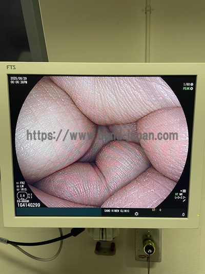 Endoscope System | FUJIFILM | EP-6000