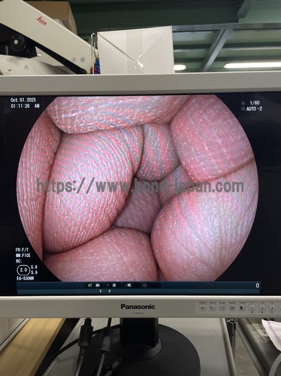 Video Gastroscope | FUJIFILM | EG-530NW