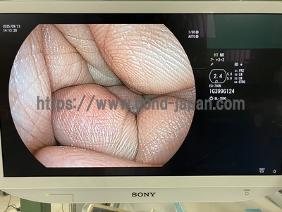 Video Gastroscope | FUJIFILM | EG-740N