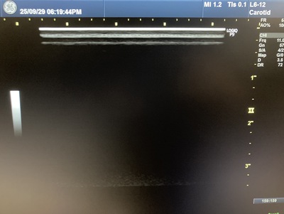 Ultrasound&nbsp;|&nbsp;GE&nbsp;|&nbsp;LOGIQ P9