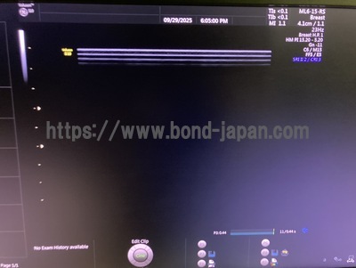 4D Ultrasound | GE | Voluson S10 BT16