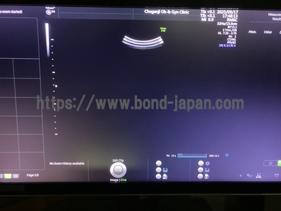4D Ultrasound | GE | Voluson E10 BT17