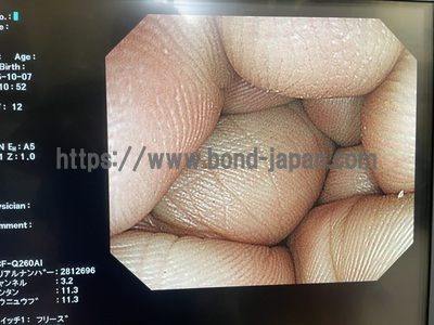 Video Colonoscope | OLYMPUS | PCF-Q260AI