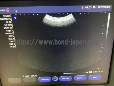 超音波診断装置 | 持田シーメンスメディカルシステム株式会社 | Sonovista FX PEの写真
