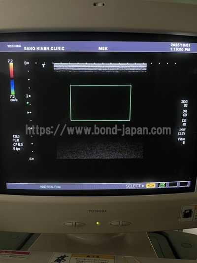 Ultrasound Color Doppler | CANON | SSA-700A Aplio50
