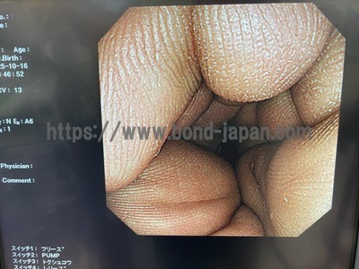 Video Colonoscope | OLYMPUS | CF-240AI