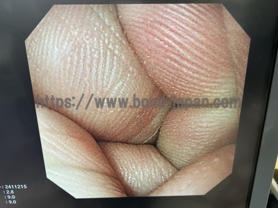 Video Gastroscope | OLYMPUS | GIF-XQ260