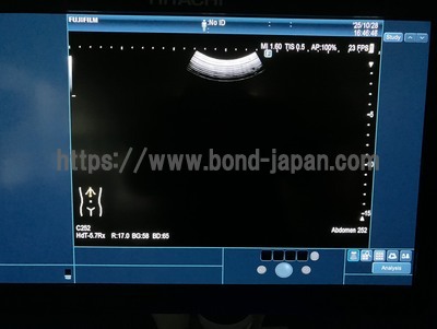 Ultrasound System&nbsp;|&nbsp;FUJIFILM&nbsp;|&nbsp;ARIETTA 850