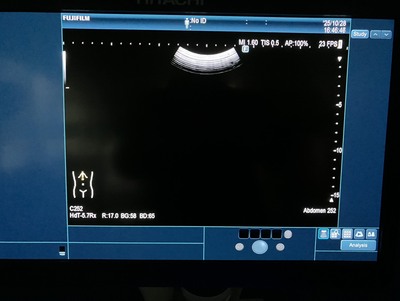 Ultrasound System&nbsp;|&nbsp;FUJIFILM&nbsp;|&nbsp;ARIETTA 850