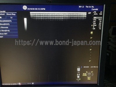 Color Doppler | GE | Logiq S7 Expert