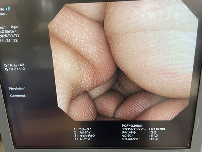 Video Colonoscope | OLYMPUS | PCF-Q260AI