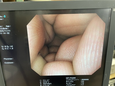 Video Gastroscope | OLYMPUS | GIF-PQ260