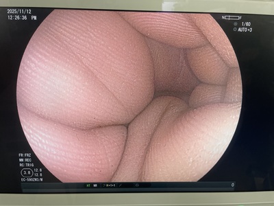 Video Colonoscope | FUJIFILM | EC-590ZW3/M