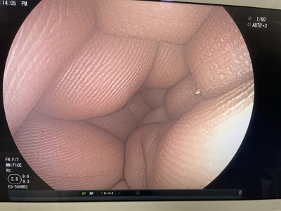 Video Gastroscope | FUJIFILM | EG-590WR2