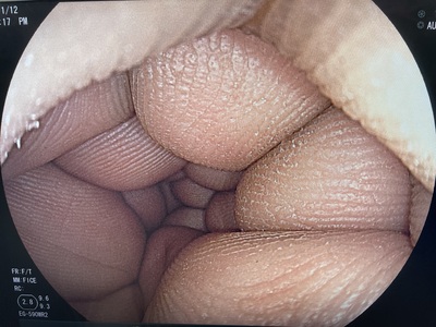 Video Gastroscope | FUJIFILM | EG-590WR2