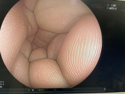 Video Colonoscope | FUJIFILM | EC-590WM3