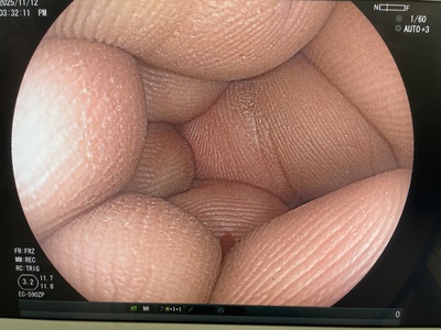 Colonoscope | FUJIFILM | EC-590ZP