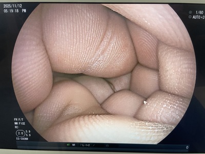  | FUJIFILM | EG-580NW