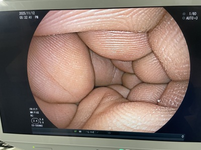 Video Gastroscope | FUJIFILM | EG-580NW2