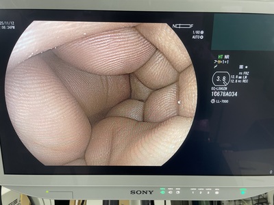 Colonoscope | FUJIFILM | EC-L590WM