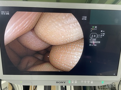 Video Gastroscope | FUJIFILM | EG-L590WR