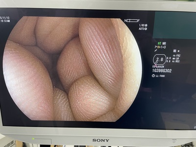 Video Gastroscope | FUJIFILM | EG-L600ZW