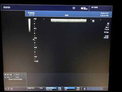  | CANON | TUS-X100S  Xario 100S