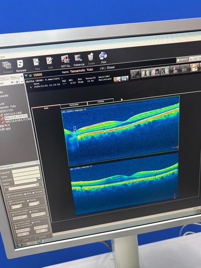 Retinal Camera and OCT Combined | NIDEK | RS-3000