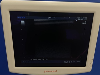 Color Doppler&nbsp;|&nbsp;ALOKA&nbsp;|&nbsp;SSD-3500SX