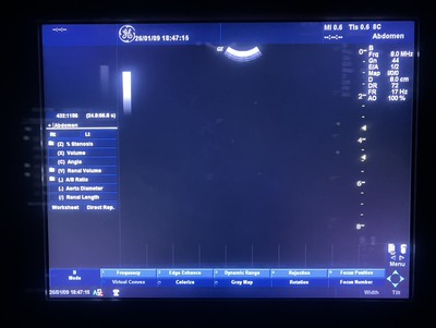 Color Doppler&nbsp;|&nbsp;GE&nbsp;|&nbsp;LOGIQ P5