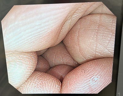 &nbsp;|&nbsp;OLYMPUS&nbsp;|&nbsp;PCF-PQ260I