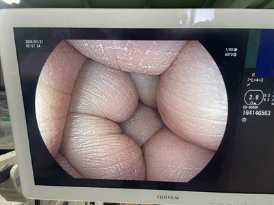 上部消化管用汎用スコープ&nbsp;|&nbsp;富士フイルムメディカル&nbsp;|&nbsp;EG-6600Rの写真