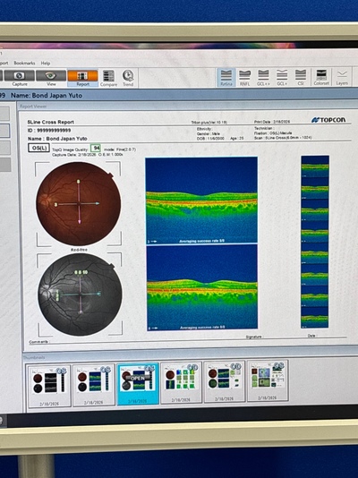 2021 OCT with angiography&nbsp;|&nbsp;TOPCON&nbsp;|&nbsp;DRI OCT Triton plus