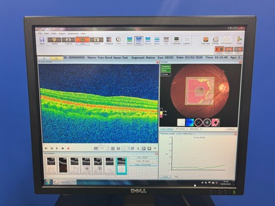 OCT With Angiography&nbsp;|&nbsp;TOPCON&nbsp;|&nbsp;DRI OCT Triton plus