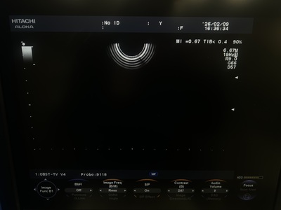 Color Doppler&nbsp;|&nbsp;HITACHI&nbsp;|&nbsp;F37