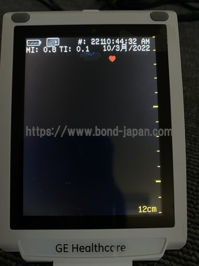 超音波診断装置/カラードプラ | GEヘルスケア・ジャパン株式会社 | Vscan Dual Probeの写真