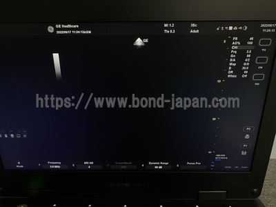 超音波診断装置 | GEヘルスケア・ジャパン株式会社 | Versana Activeの写真