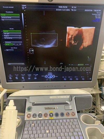 4D Ultrasound | GE | Voluson S8