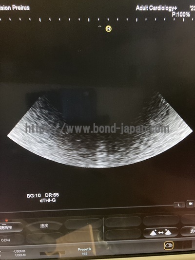 Color Doppler | HITACHI | Hi Vision Preirus