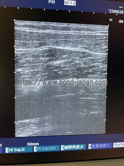 Ultrasound color doppler | HITACHI | EUB-7000HV