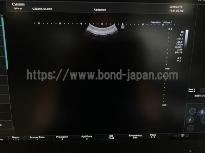 Ultrasound System | CANON | Aplio Go