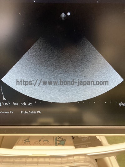 Color Doppler | HITACHI | F75