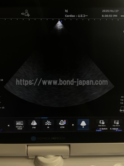 Ultrasound | konica | SONIMAGE HS1