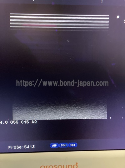 Color Doppler | HITACHI | Prosound α6