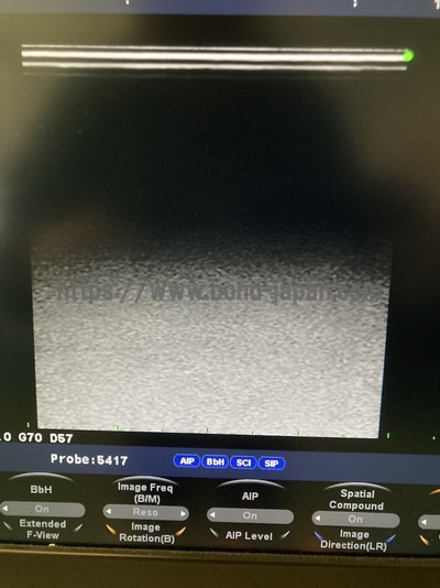 Color Doppler | HITACHI | F37